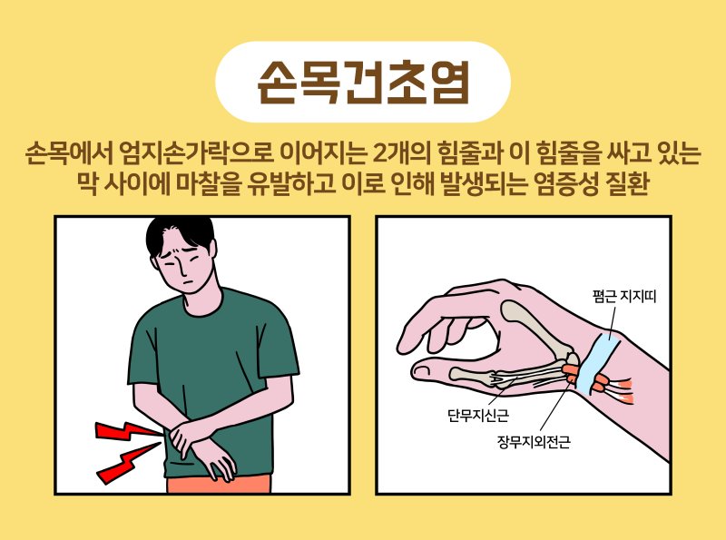 [서울=뉴시스]대부분 손목이나 엄지손가락에 통증이 생기면 사용하지 않거나 쉬면 나아진다고 생각한다. 하지만 손목은 가장 많이 사용하는 관절인 만큼 지속적인 통증을 참기 보다 빠르게 치료를 받는 게 좋다.