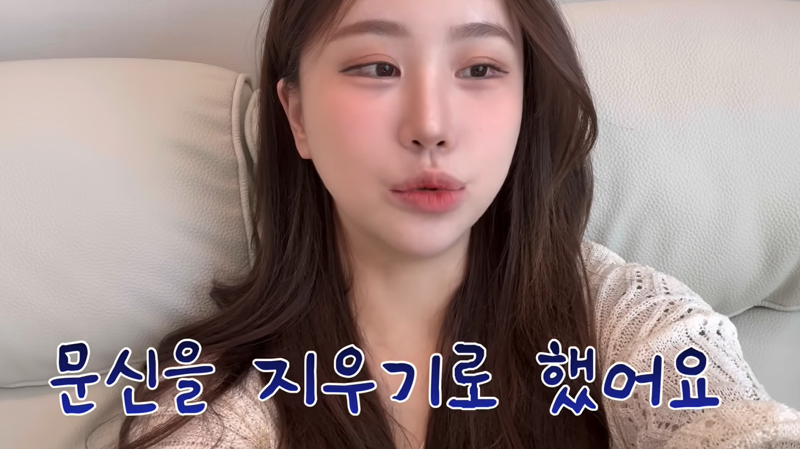 "죽을 것 같다"는 그 경험… 유튜버의 '팔 전체 문신' 지운 후기 