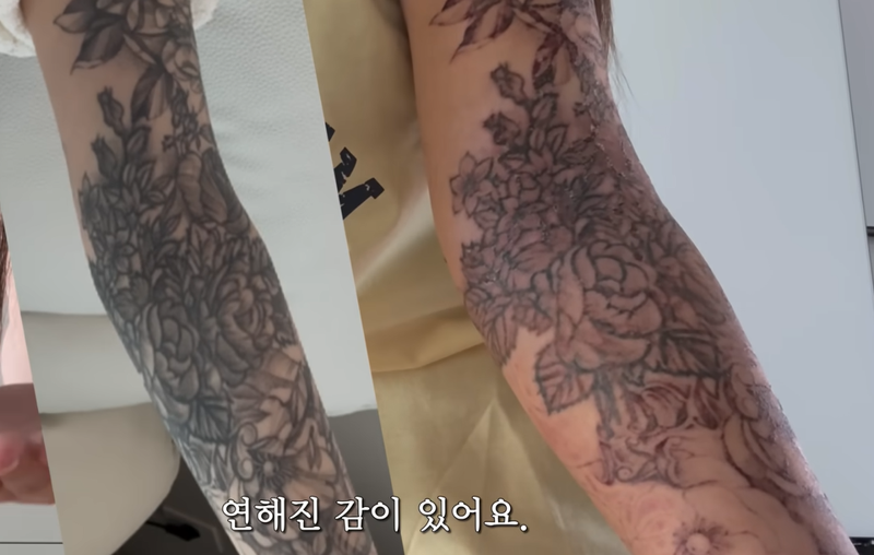 "죽을 것 같다"는 그 경험… 유튜버의 '팔 전체 문신' 지운 후기 