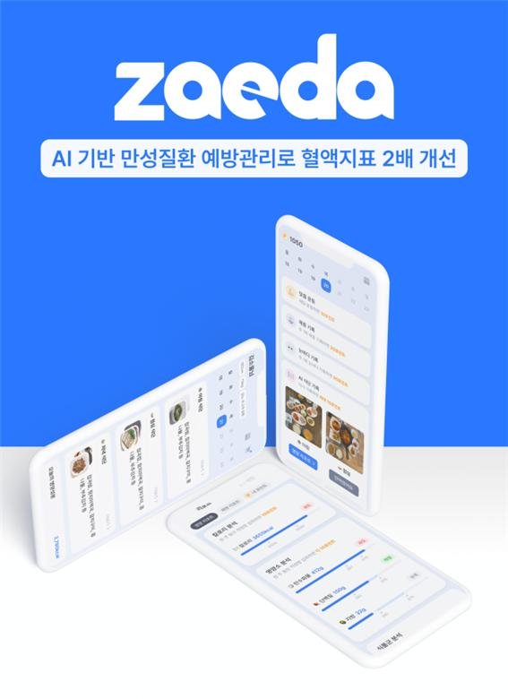 소울소프트-마이크로의료로봇硏, AI 건강관리 서비스 구축 '맞손' - 파이낸셜뉴스