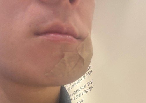 "골프공엔 죄가 없다" 마라토너 얼굴 가격한 골프공… 경찰 '골프장 안전 소홀'