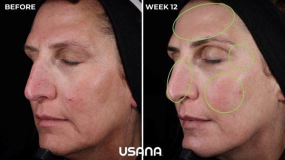 유사나, 셀라비브 앰플 세럼 임상 결과 발표…“4주 만에 피부 전반 개선”