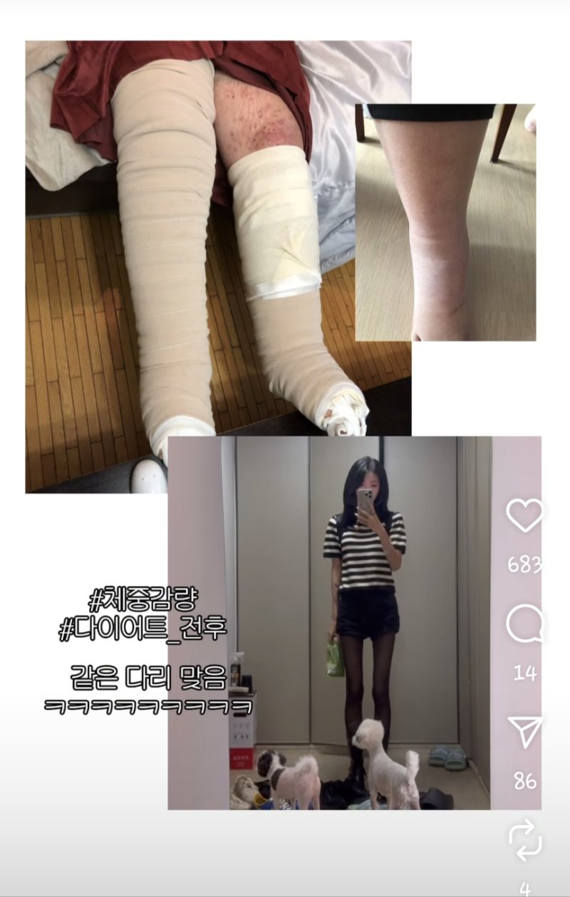 최준희, 96→41㎏ 다이어트 전후 공개…"삶이 바뀜"