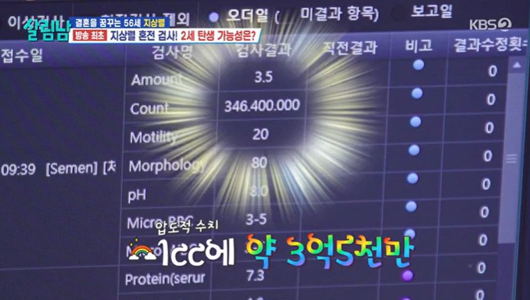 전문의도 놀란 개그맨 지상렬 정자 양, 수치가 무려..