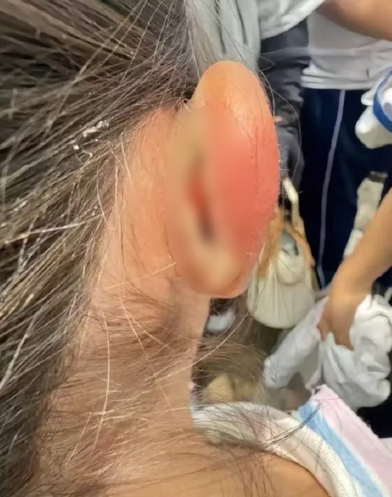 "수업 집중 안 해서"…中 교사가 학생 귀 잡아당겨 찢어져