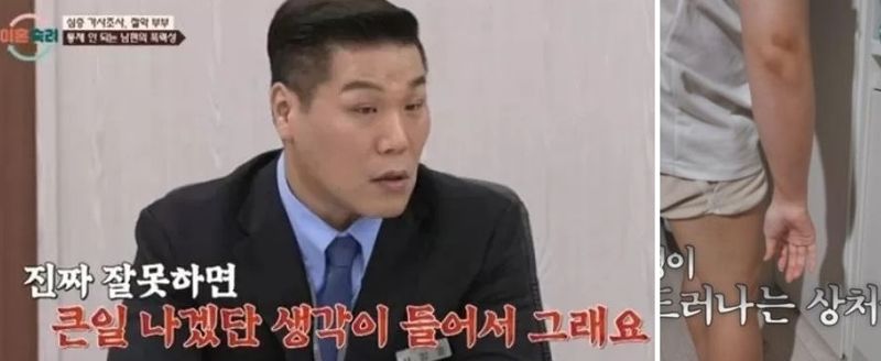 "토할 때까지 아내 얼굴 때렸다"...'이혼숙려캠프' 남편, 끔찍한 폭행