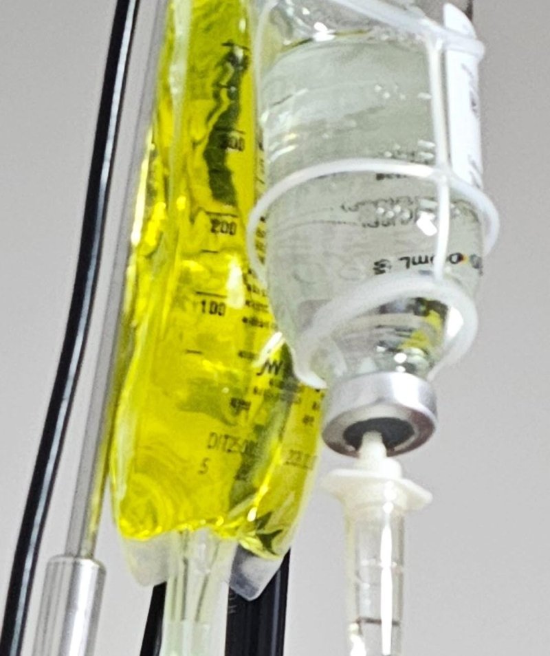 이경실, 링거 투혼 후 건강 악화 "목소리도 안 나와"