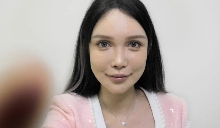 얼굴 멍들고, 피부 들뜨는데…멈출 수 없는 중국의 ‘예쁨 중독’