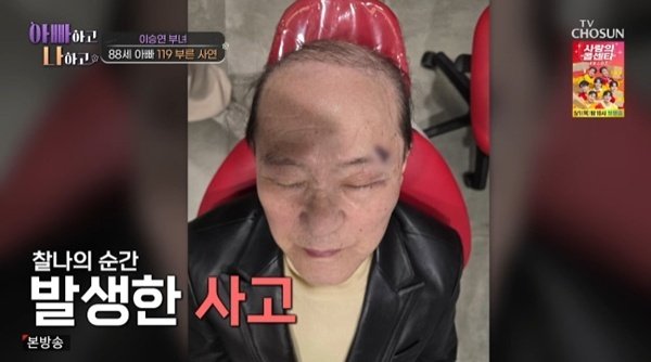 이승연 "父, 계단 사고로 봉합 수술"…구급차 영상 공개
