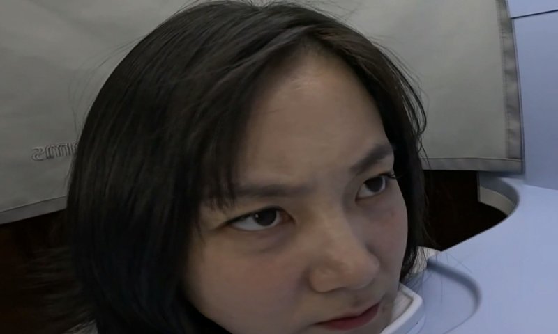 "수치스럽다" 박나래, 탈모 전문 병원 찾았다…두피 상태에 충격