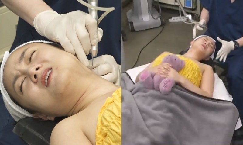 "수치스럽다" 박나래, 탈모 전문 병원 찾았다…두피 상태에 충격