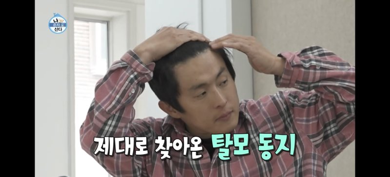 '3대째 대머리 끊은' 기안84 "M자 700모 심었다"