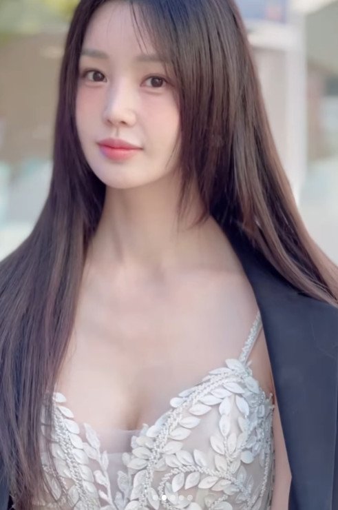 1xbet 우회 SNS