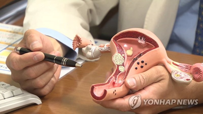 자궁 (출처=연합뉴스)