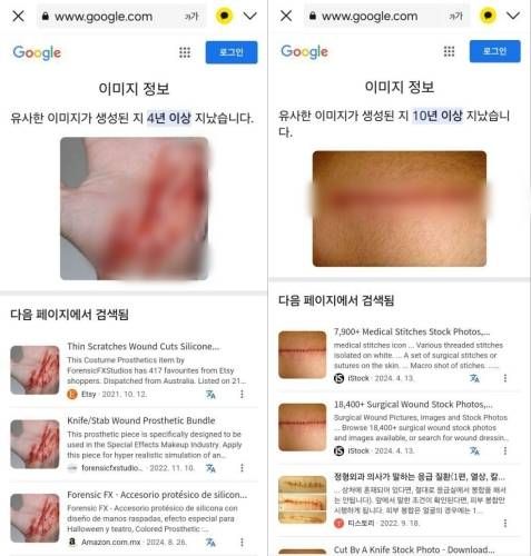 故김새론 녹취 제보자, 괴한 칼에 9차례 찔려..이진호 "피습 사진 전부 조작"