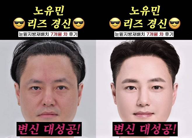 노유민, 눈 밑 '지방 재배치' 리즈 경신 "민증 검사 받아"
