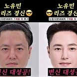 노유민, 눈 밑 ′지방 재배치′ 리즈 경신 ″민증 검사 받아″