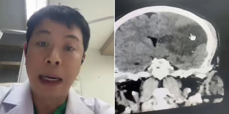 승부 식 토토 치앙마이에서 활동하는 신경외과 전문의 프라차가 SNS에 잘못된 승부 식 토토의 위험을 알린 글을 올렸다. /사진=프라차 페이스북, 뉴시스