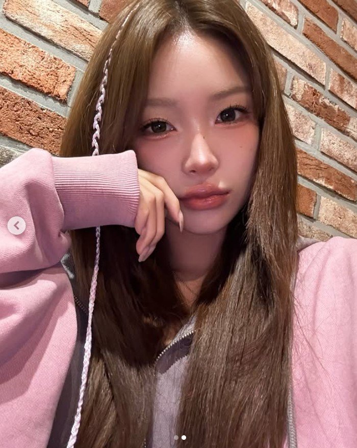 '55㎏ 감량' 최준희, 눈&middot;코 성형고백 후 또 수술