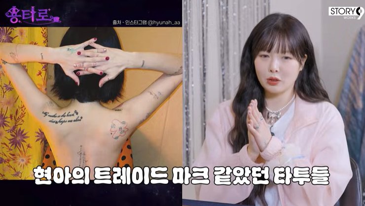 현아, 母 부탁에 문신 제거한 근황…"1년째 지우는 중"