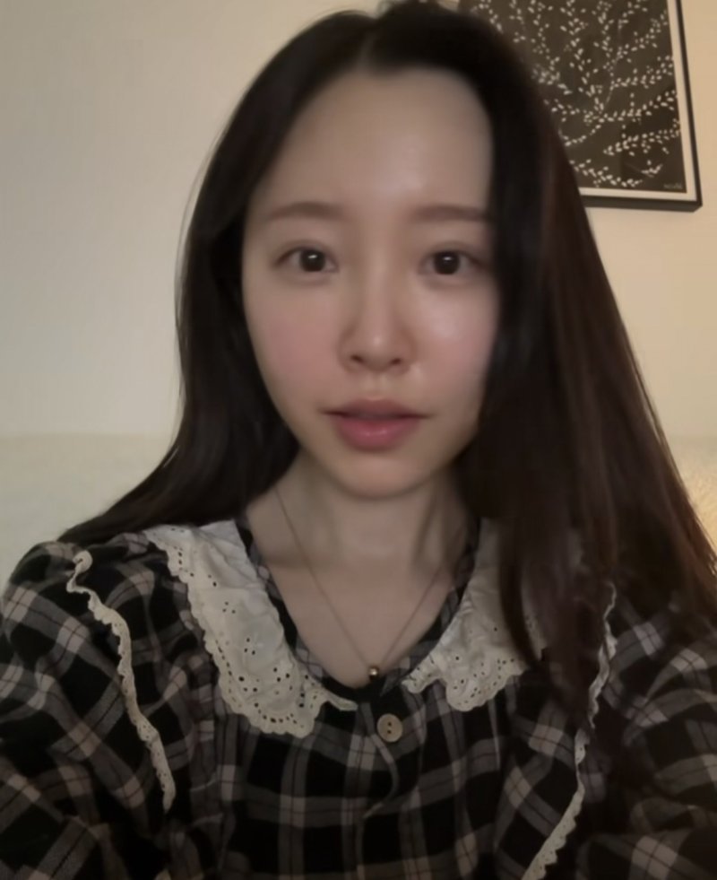 '박성광 아내' 이솔이, 암투병 고백 후 "얼굴형 달라졌다"