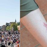 놀이동산서 놀았을 뿐인데 붉은 반점이…′디즈니 발진′의 정체
