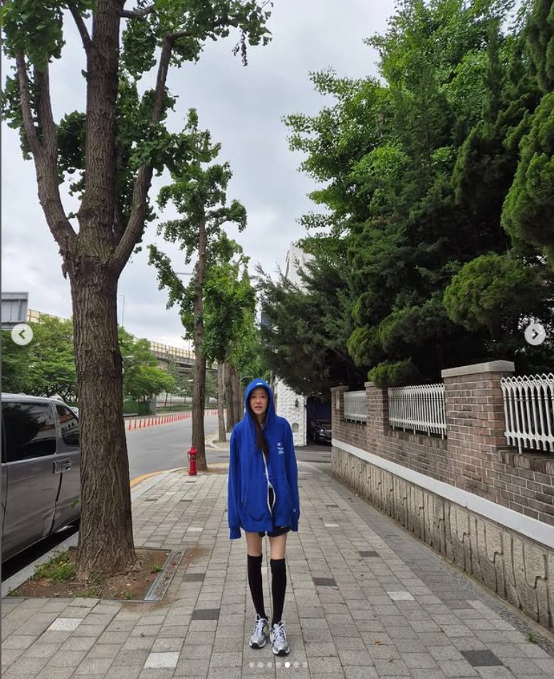 고현정, 큰 수술 후에 야윈 근황…극세사 다리로 "휘청휘청" [N샷]