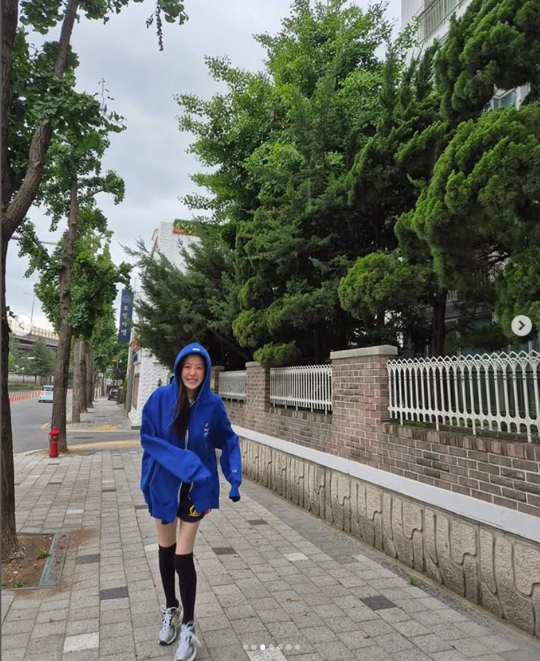 고현정, 큰 수술 후에 야윈 근황…극세사 다리로 휘청휘청 [N샷]