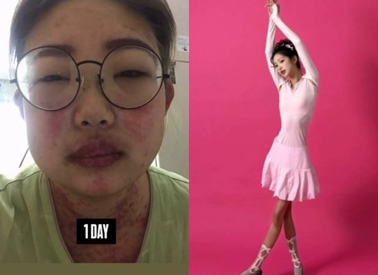 최준희 나락서 50kg 감량 후 41kg로…나를 사랑하게 돼 비교 사진 공개 [N샷]