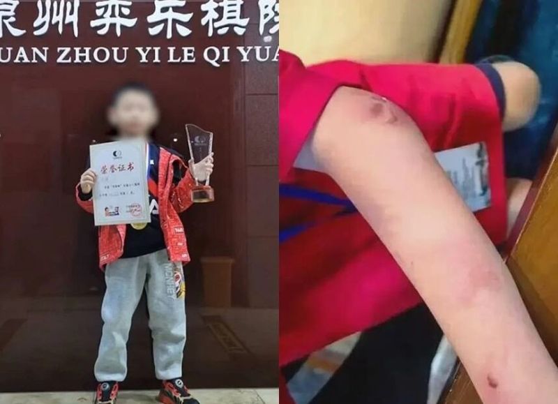 "경기 질때마다 아버지가 폭행"..9세 바둑 천재 사망에 中 발칵