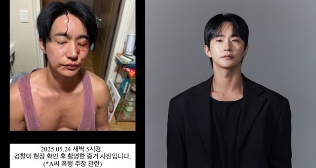 전호준, 전여친 폭행 주장에 반박…피 묻은 얼굴 피해 사진·녹음본 공개