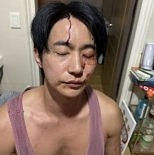 전 여친 ″폭행에 성병″…배우 전호준 ″맞은 건 나″ 반박