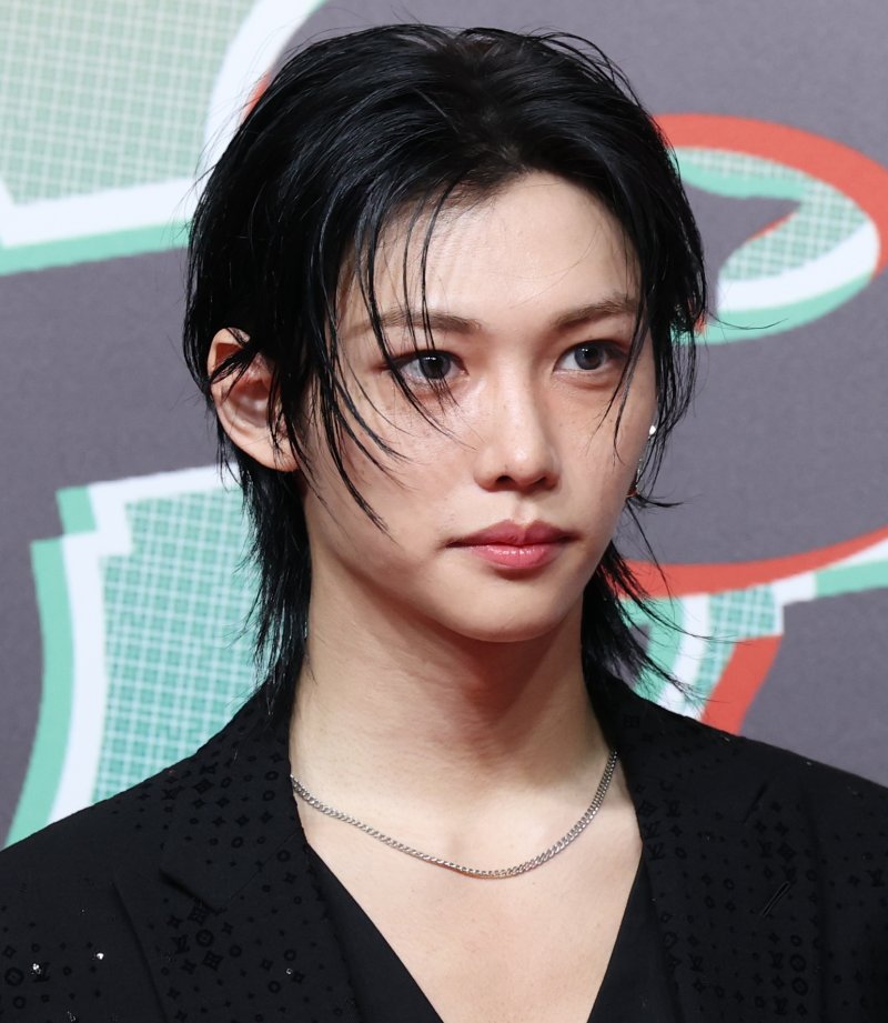 스키즈 필릭스, 허리 통증으로 치료 중 퍼포먼스 유동적 변경