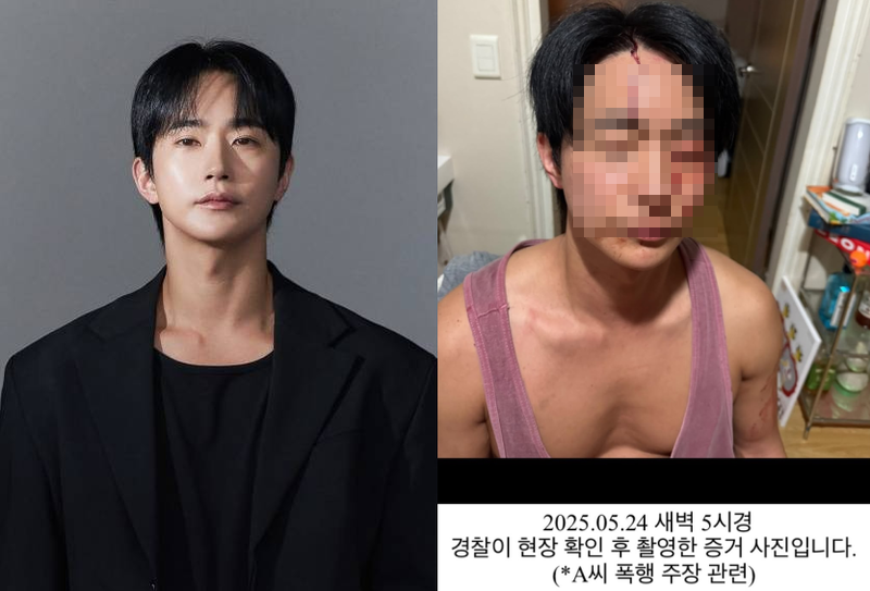 폭행·갈취·성병 주장에…전호준 "정당방위" 반박