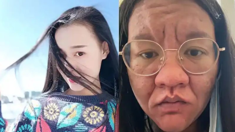 [서울=뉴시스]중국 윈난성 쿤밍의 한 여성이 임신과 메이저 바카라사이트 전후의 극적인 외모 변화를 공유해 큰 화제를 모았다.(사진= 观象视频) *재판매 및 DB 금지