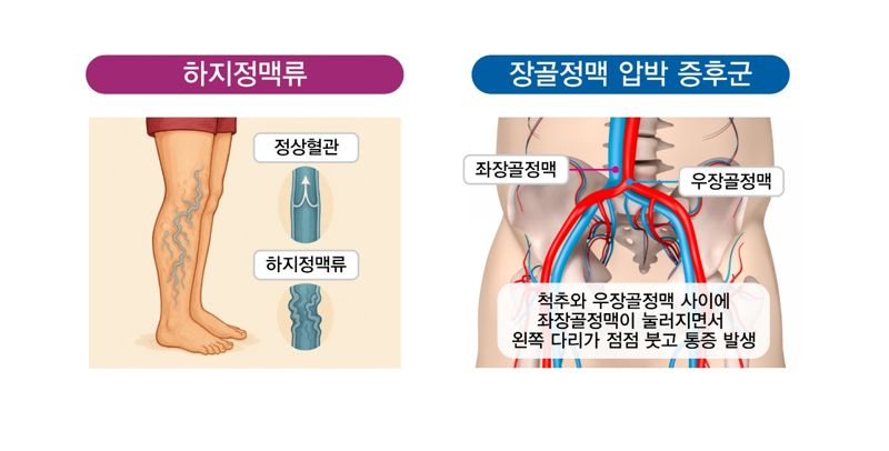 인기있는바카라사이트? 인기있는바카라사이트? 헷갈린다면…