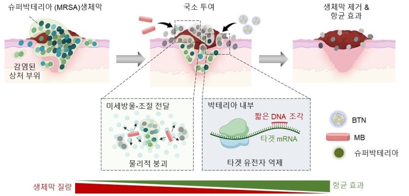 슈퍼박테리아를 표적하는 유전자 치료제의 작동 원리 모식도(KAIST 제공) /뉴스1