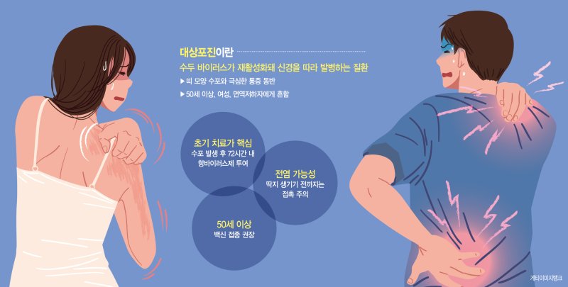 피부 찢어질듯 아픈 ‘대상포진’… 수포 발생후 72시간이 골든타임 [Weekend 헬스]