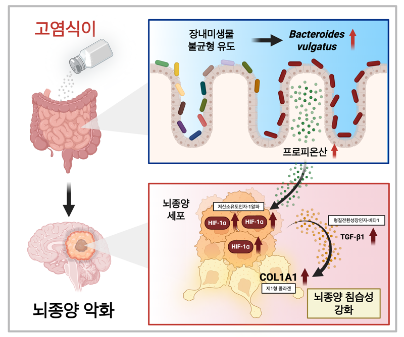 "짠 음식, 뇌종양도 악화" 세계 첫 원인규명