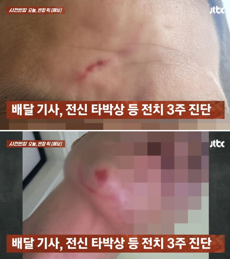 길가에 배달오토바이 발로 차더니, 기사까지 폭행한 男... CCTV 보니