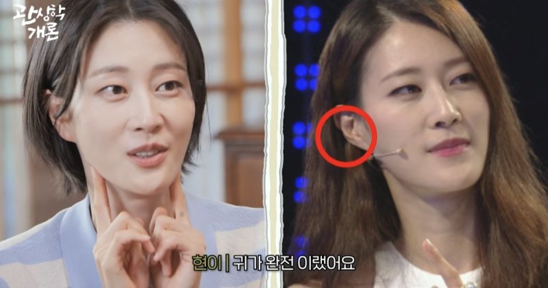 이현이 "'돈 줄줄 샌다'는 말에 귀 필러 맞았다"