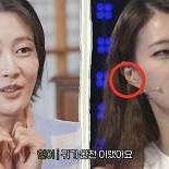 이현이 ″′돈 줄줄 샌다′는 말에 귀 필러 맞았다″