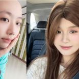 매운 음식 과다 섭취한 女, 복통으로 병원 가보니 병명이..
