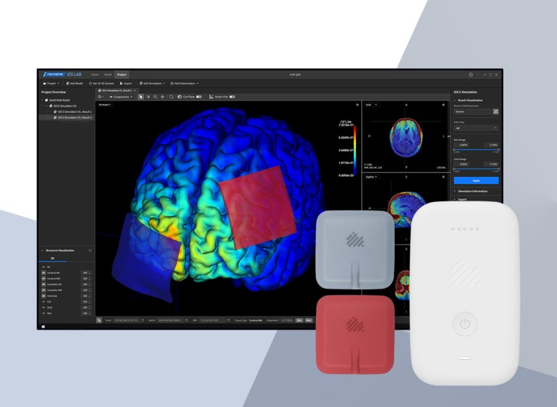 [서울=뉴시스] 바카라 에볼루션은 뇌 자기공명영상(MRI)를 활용한 AI 기반 맞춤형 경두개직류자극술(tDCS)이 혁신의료기술로 선정됐다고 3일 밝혔다. (사진=바카라 에볼루션 제공) 2025.06.04. photo@newsis.com *재판매 및 DB 금지