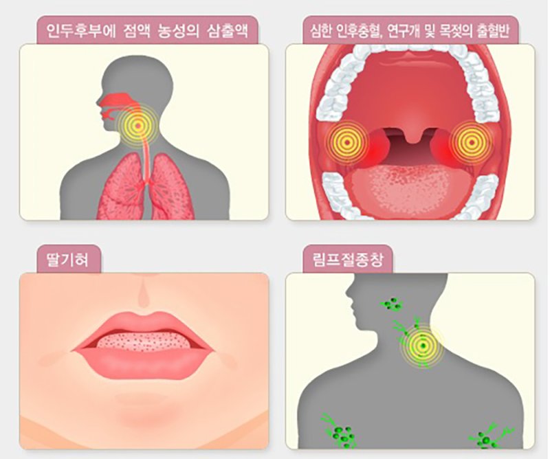 [광주=뉴시스] 광주보건환경연구원, 법정감염병 라이트닝 바카라 사이트 급증. (사진=광주보건환경연구원 제공). photo@newsis.com *재판매 및 DB 금지