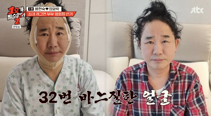 최양락, 쌍꺼풀 수술·안면거상술 받아 "페이스오프 수준"