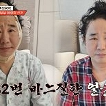 최양락, 쌍꺼풀 수술·안면거상술 받아 ″페이스오프 수준″
