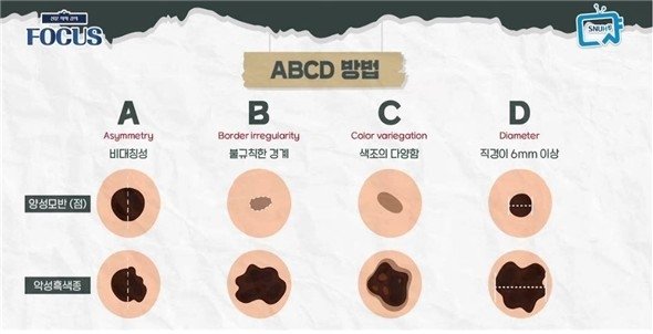 ABCD 자가진단 체크포인트 (출처=연합뉴스)
