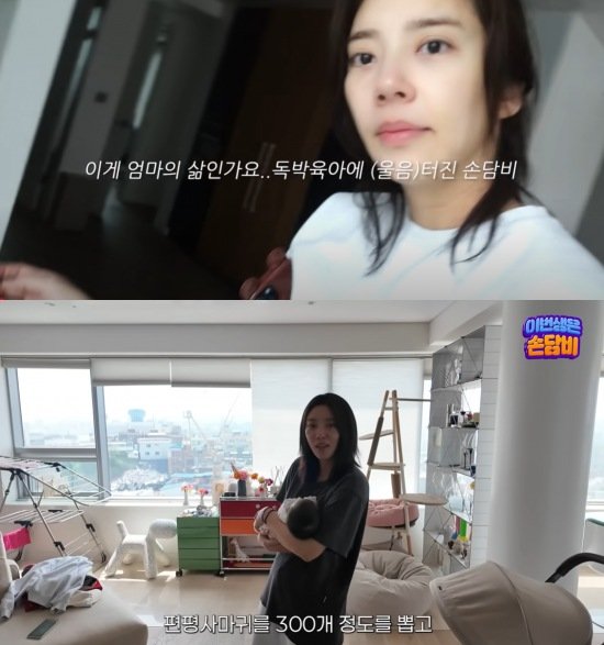 '딸 출산' 손담비 "얼굴·목 편평사마귀 300개 제거"