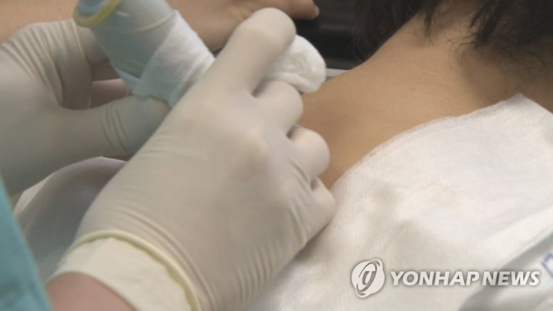 대상포진 치료 (출처=연합뉴스)